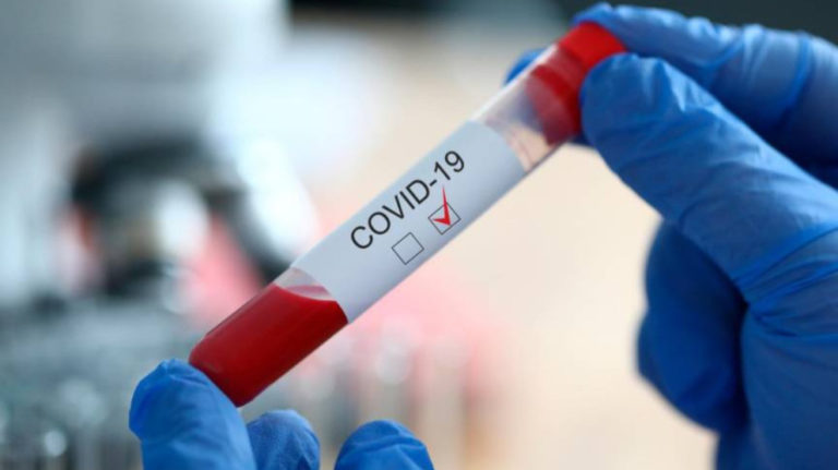 COVID-19. Au moins 55 Kurdes sont morts du coronavirus en Europe