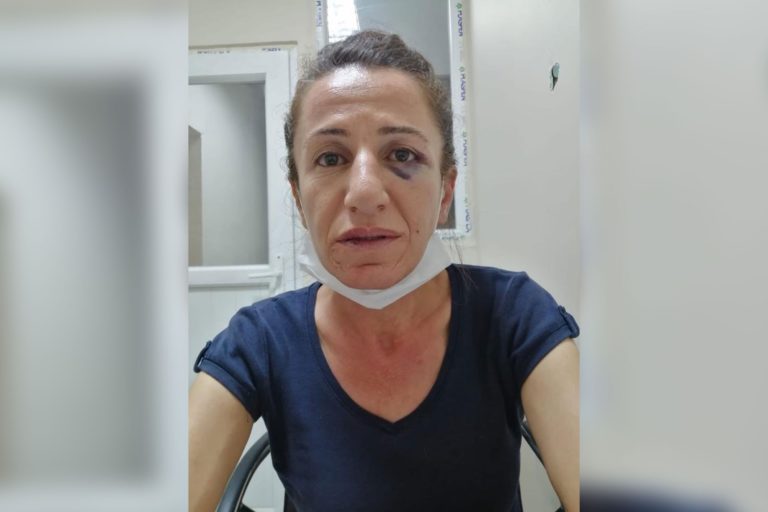 TURQUIE. La prisonnière kurde, Rojbin Çetin privée de soins contre son cancer de l’utérus