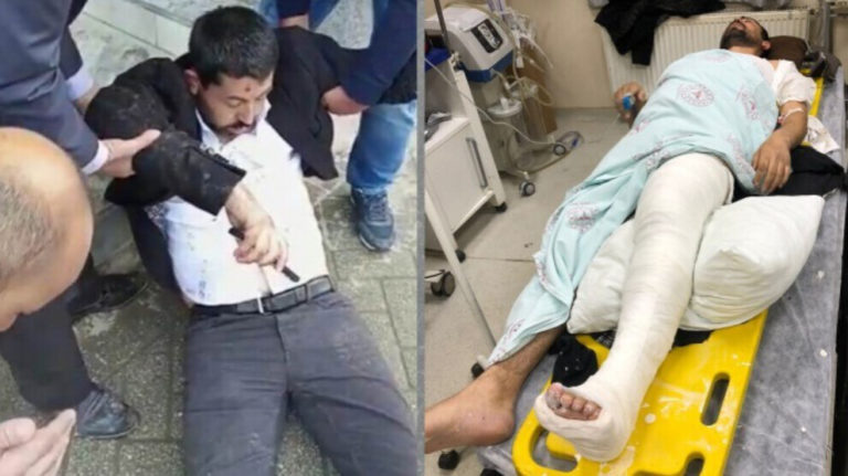 TURQUIE. Un député kurde HDP tabassé par la police turque qui lui a fracturé la jambe