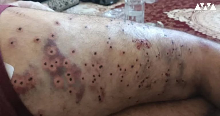 IRAN. Les manifestants blessés demandent l’aide de Médecin Sans Frontières