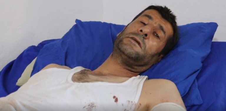 ROJAVA. La Turquie a ciblé l’hôpital de Tall Rifaat: 4 blessés