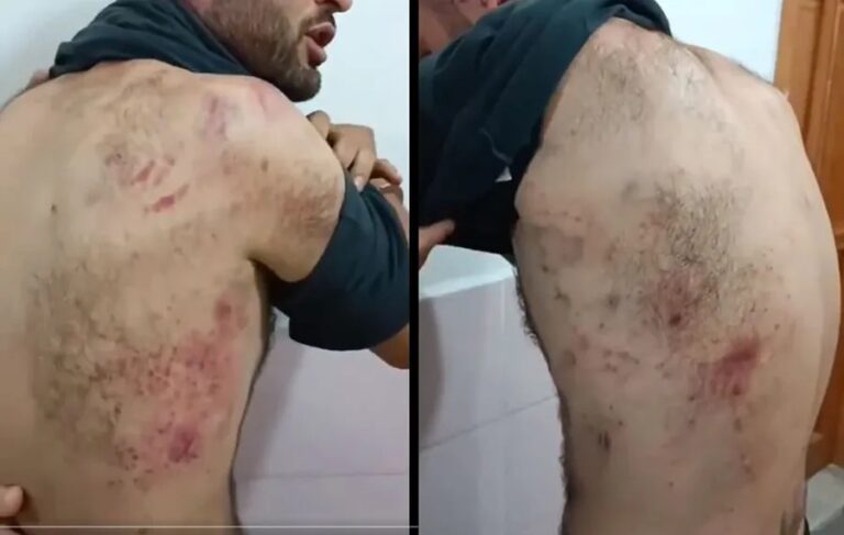 TURQUIE. Un jeune Kurde torturé en détention par des soldats