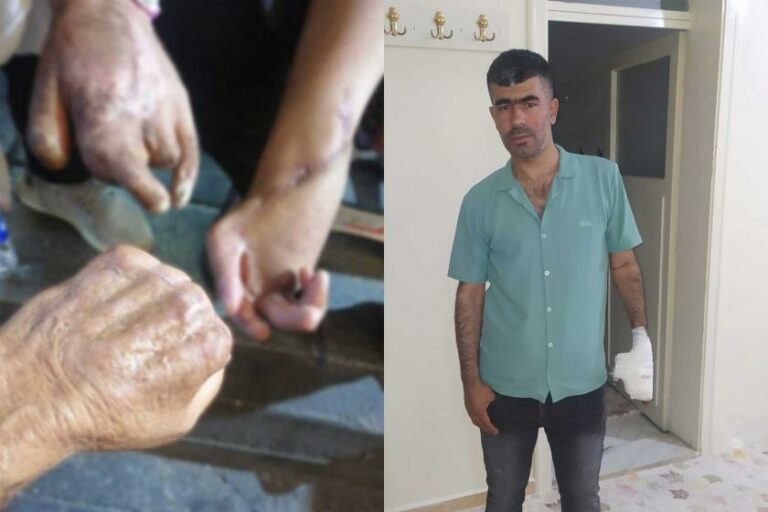 TURQUIE. Pub pour la chirurgie de la main dans une zone industrielle à fort taux d’accidents
