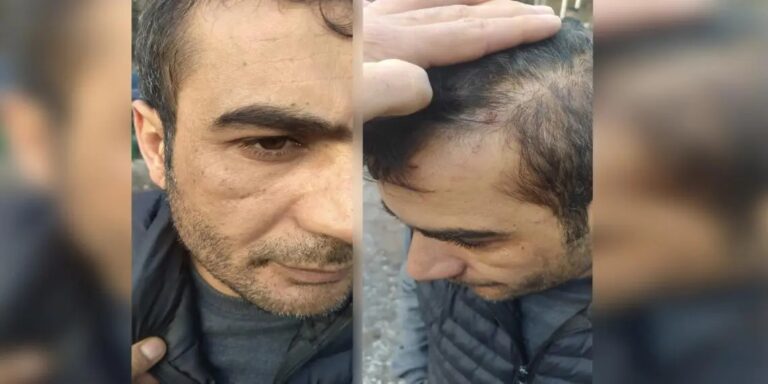 TURQUIE. Des ouvriers kurdes licenciés après une attaque raciste 