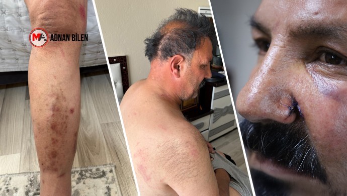 TURQUIE. Un couple kurde tabassé et menacé de mort lors d’un raid policier à Van