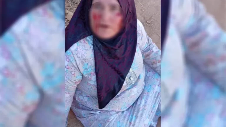 ROJAVA. Les gangs de Damas blessent une femme kurde à Tal Aran